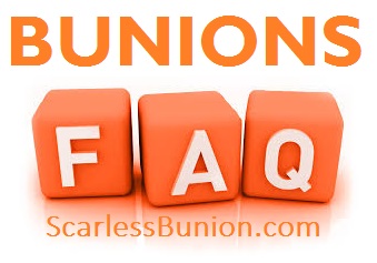 Bunions FAQ