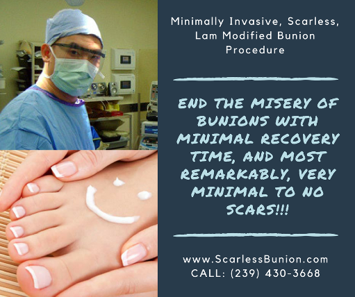 no scar bunion surgery
