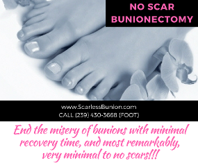 No scar bunionectomy