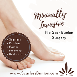 no scar bunion surgery 
